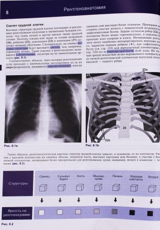Рентгенологическое исследование грудной клетки фото книги 2
