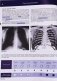 Рентгенологическое исследование грудной клетки фото книги маленькое 3