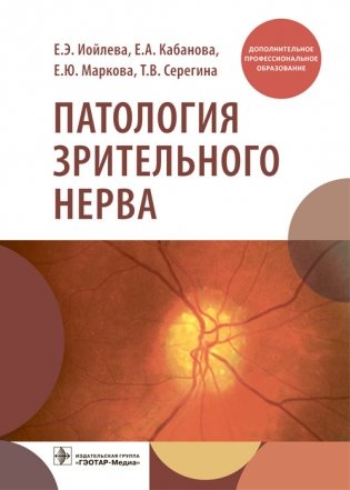 Патология зрительного нерва фото книги