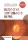 Патология зрительного нерва фото книги маленькое 2