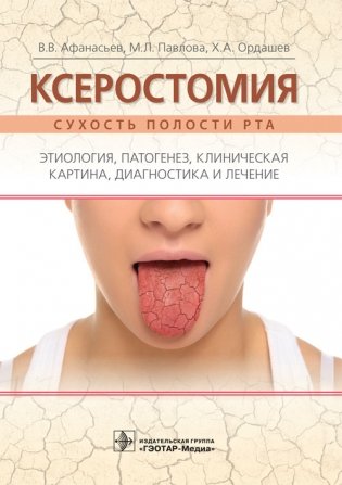 Ксеростомия (сухость полости рта). Этиология, патогенез, клиническая картина, диагностика и лечение фото книги