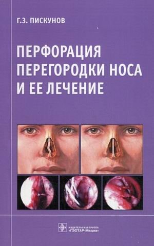 Перфорация перегородки носа и ее лечение фото книги