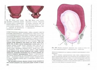 Сестринская помощь в акушерстве и при патологии репродуктивной системы у женщин и мужчин фото книги 2