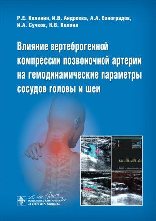 Влияние вертеброгенной компрессии позвоночной артерии на гемодинамические параметры сосудов головы и шеи фото книги