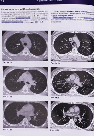 Рентгенологическое исследование грудной клетки фото книги 8