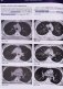 Рентгенологическое исследование грудной клетки фото книги маленькое 10