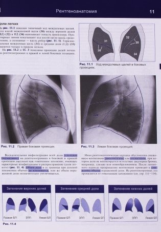 Рентгенологическое исследование грудной клетки фото книги 5