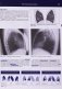 Рентгенологическое исследование грудной клетки фото книги маленькое 6