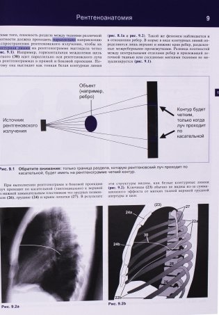 Рентгенологическое исследование грудной клетки фото книги 3