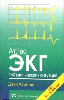 Атлас ЭКГ. 150 клинических ситуаций фото книги