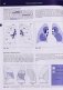 Рентгенологическое исследование грудной клетки фото книги маленькое 5