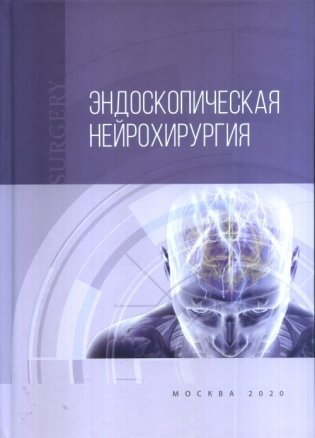 Эндоскопическая нейрохирургия фото книги